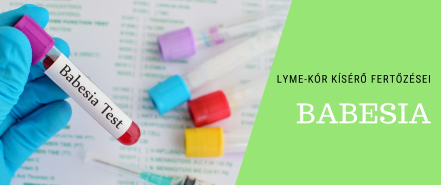 Lyme-kór kísérő fertőzései – Babesia